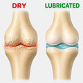 Limitless Knee Pro™ V3